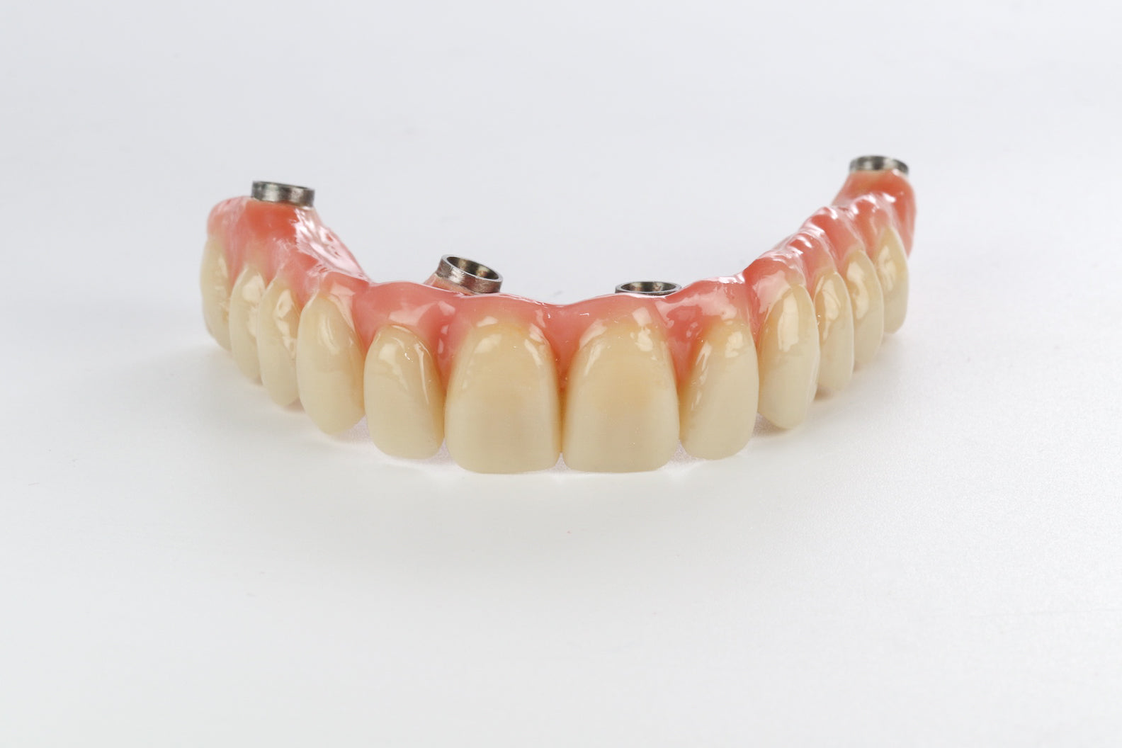 20250620-IlDente_1_D.jpg