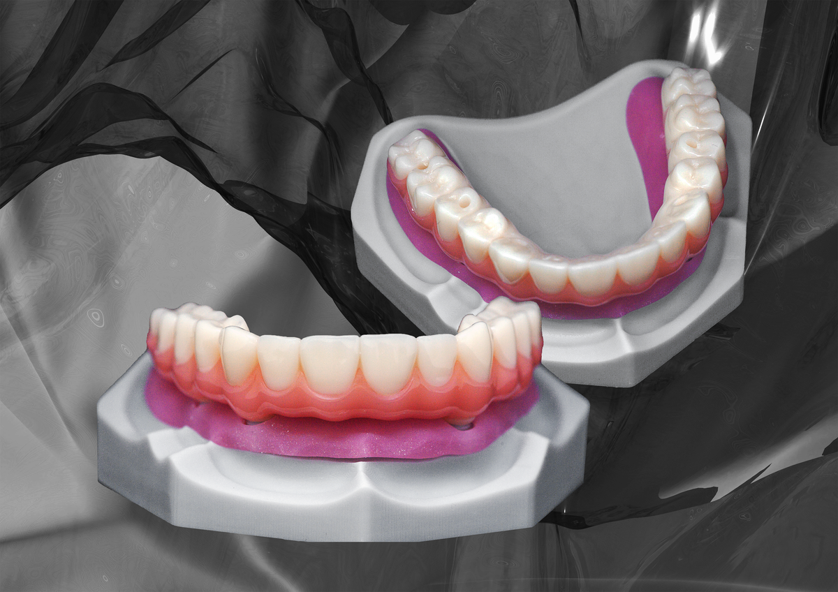 Gallery Detail: Saremco Print Crowntec 3D Printed Dental Restorations With Ce