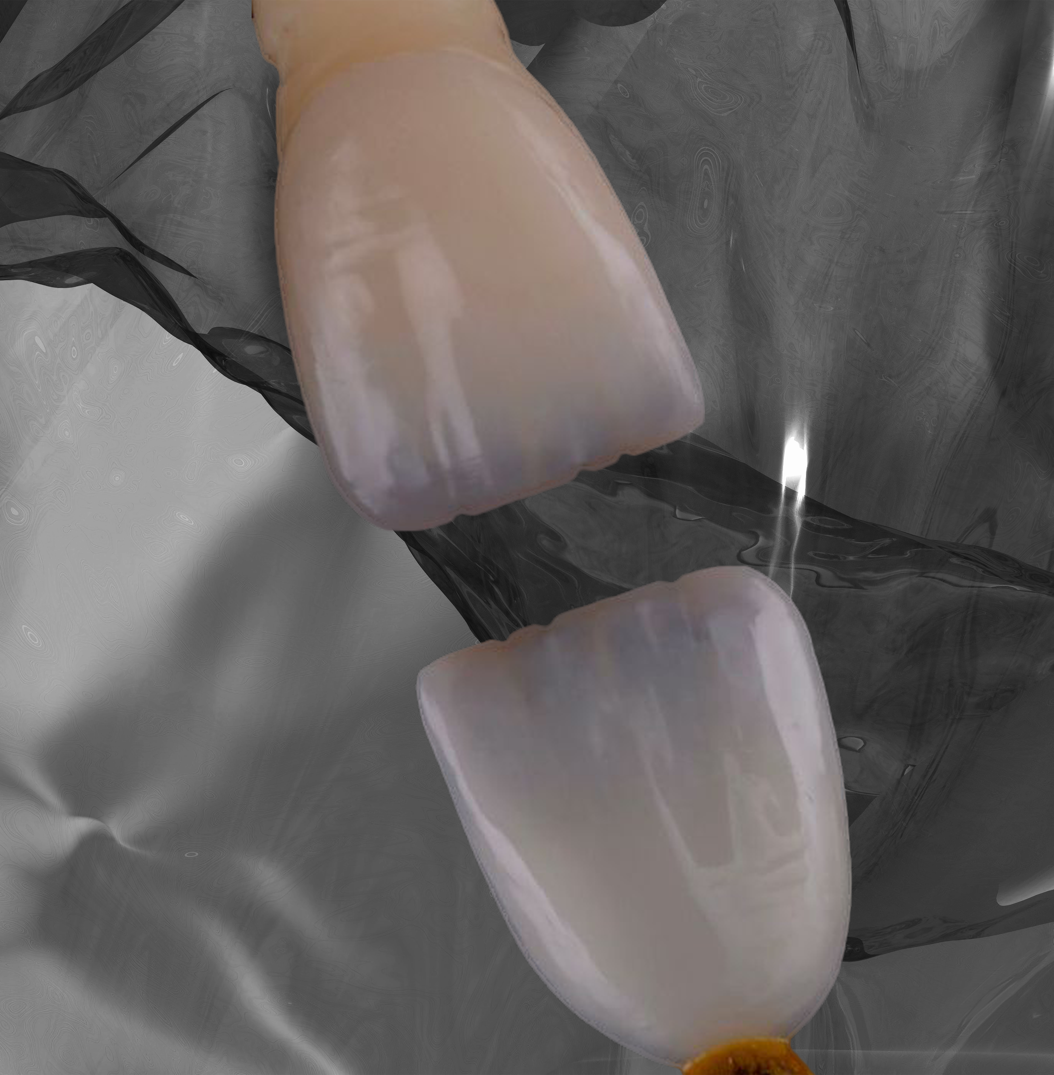 mobil_veneers.png